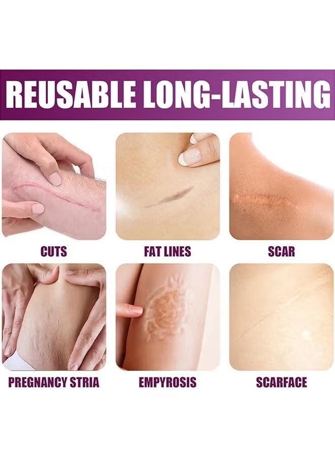RtopR Scar Removal Cream Skin Repair Creams Treatment Stretch Marks Acne Surgical Care 15G - Image 5