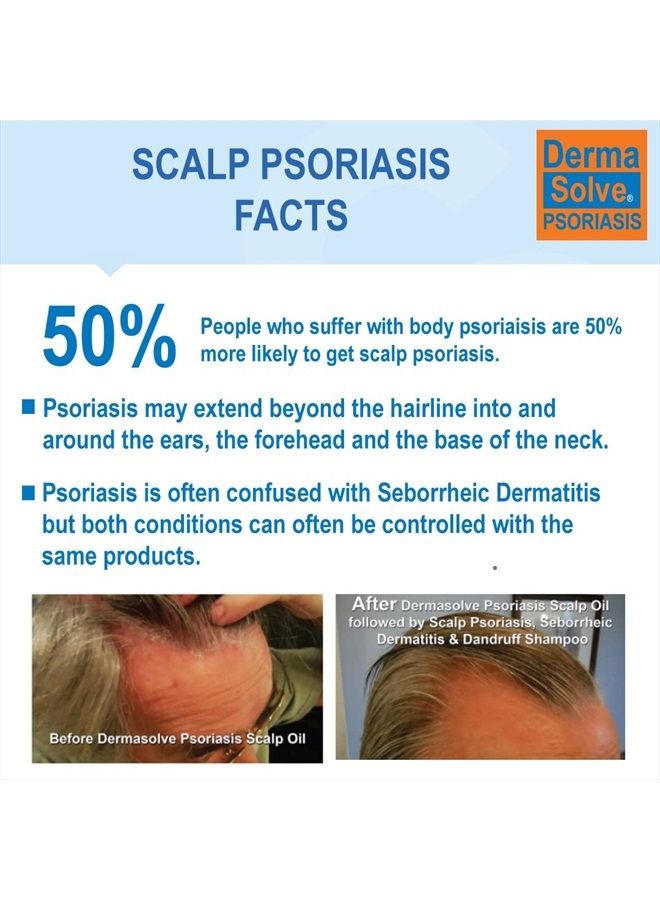 Dermasolve Psoriasis Scalp Oil 2-Pack - 4.0 oz Each, for Psoriasis, Seborrheic Dermatitis & Dandruff, Loosen Scaling, Moisturize, Soothe Itching & Flaking - Image 2