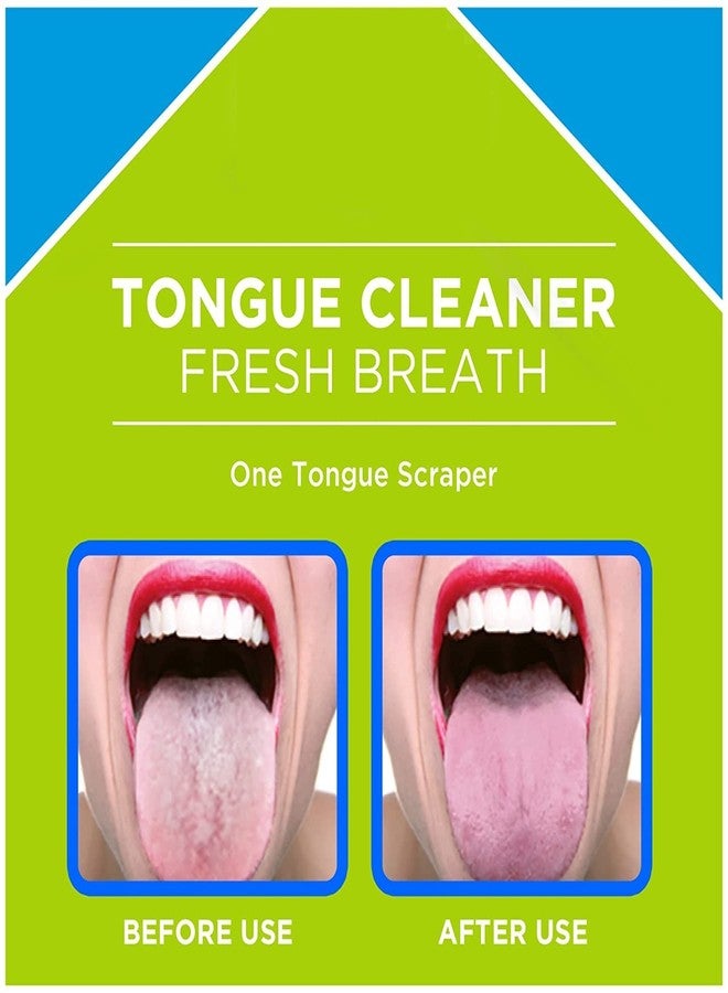 AmigozZ Tongue Cleaner, Scraper Helps Cure Bad Breath - Colors May Vary (4pcs - Image 5