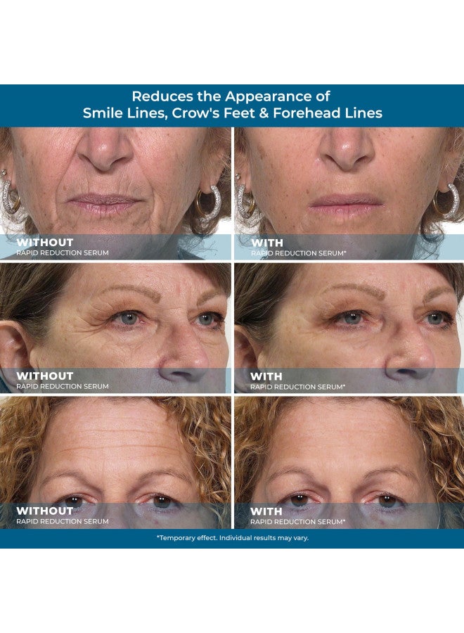 Plexaderm Rapid Reduction Eye Serum - Advanced Formula - Anti Aging Serum Visibly Reduces Under-Eye Bags, Wrinkles, Dark Circles, Fine Lines & Crow's Feet Instantly - Instant Wrinkle Remover for Face