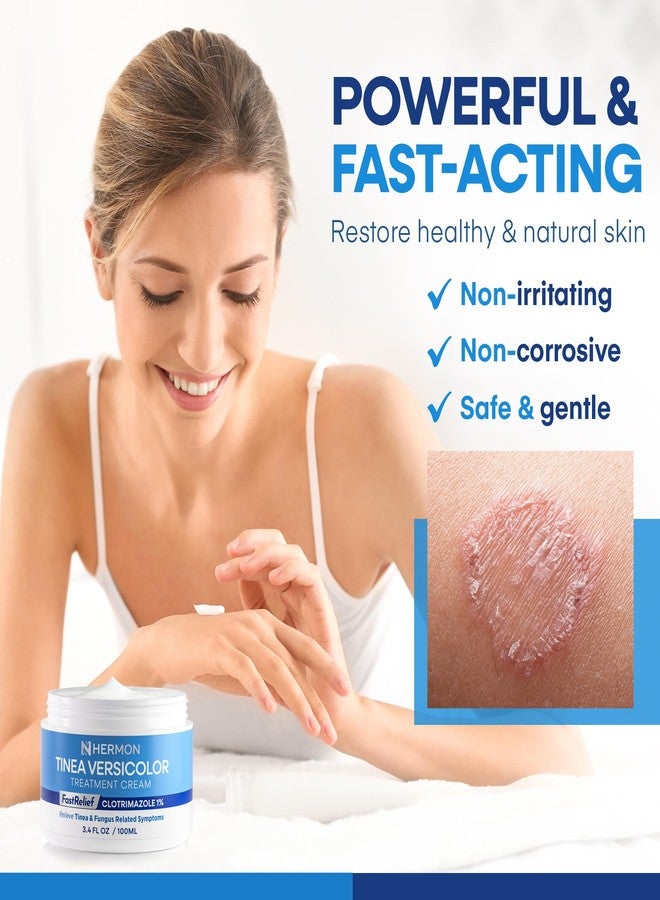 Hermon Tinea Versicolor Treatment Cream:Multi-Functional Clinically Proven 1% Clotrimazole Cream for Athlete's Foot, Tinea Versicolor, Jock Itch, Ringworm - Image 4