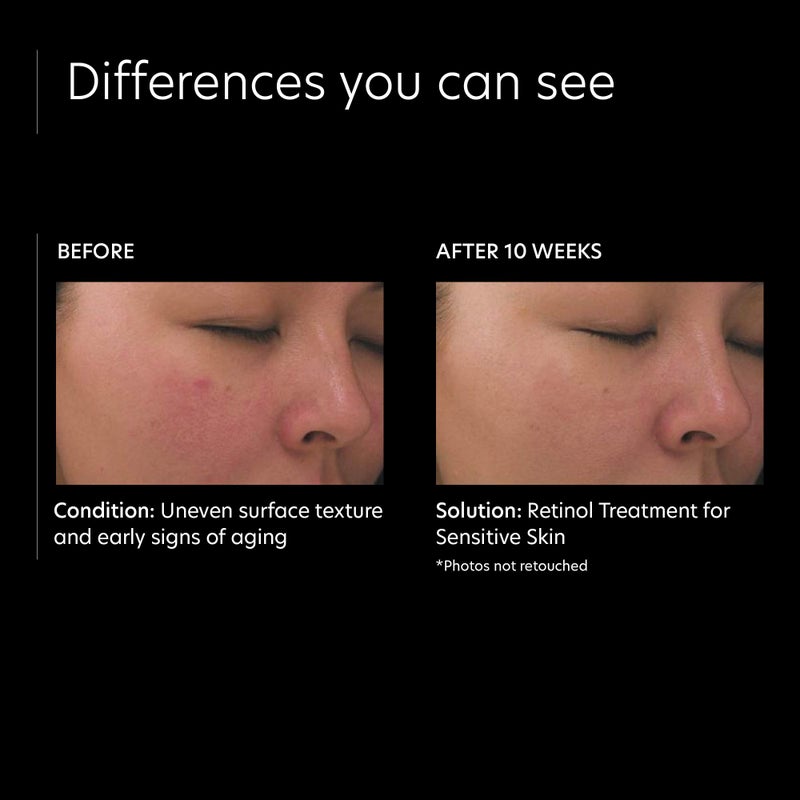 PCA SKIN Retinol Treatment for Sensitive Skin - Anti Aging Face Serum to Gently Reduce Redness & Minimize Fine Lines & Wrinkles - Contains Vitamin A & Hydrating Niacinamide (1 oz) - Image 4