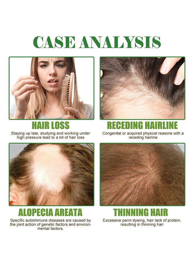 EELHOE Rosemary Mint Scalp & Hairstrengthening Oil,Hair Care Essential Oil Wash Free,Thrive Growth Hair Oil 60ml - Image 4