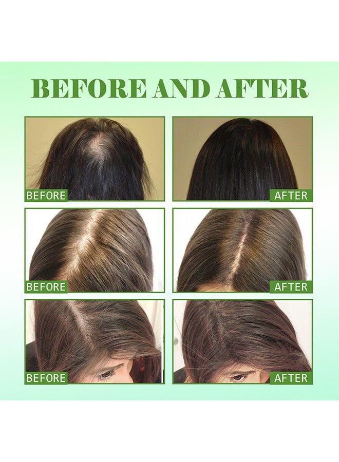 EELHOE Rosemary Mint Scalp & Hairstrengthening Oil,Hair Care Essential Oil Wash Free,Thrive Growth Hair Oil 60ml - Image 3