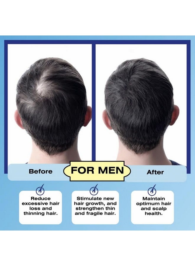 ميديسوتيكالز نومينوكس - مُنشط بصيلات الشعر من ميديسوتيكالز، 8.45 أونصة (250 مل)، مانع لهرمون ديهدروتستوستيرون للرجال - مانع لهرمون ديهدروتستوستيرون للنساء - تساقط الشعر المفاجئ - تساقط الشعر الكربي - مُحفز لبصيلات الشعر وفروة الرأس - Image 5
