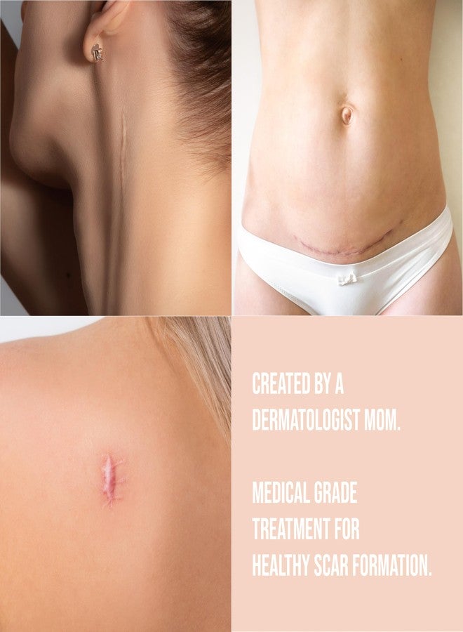 Quitch Silicone Scar Sheets for Surgical Scars, Silicone Scar Tape, C Section Recovery Must Haves, Tummy Tuck Recovery Must Haves, Postpartum Essentials Scar Treatment (Floral) 4x150cm - Image 3