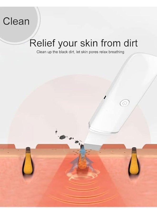 Ultrasound Facial Cleansing Device – Blackhead Removal and Pore Cleansing – White - Image 2