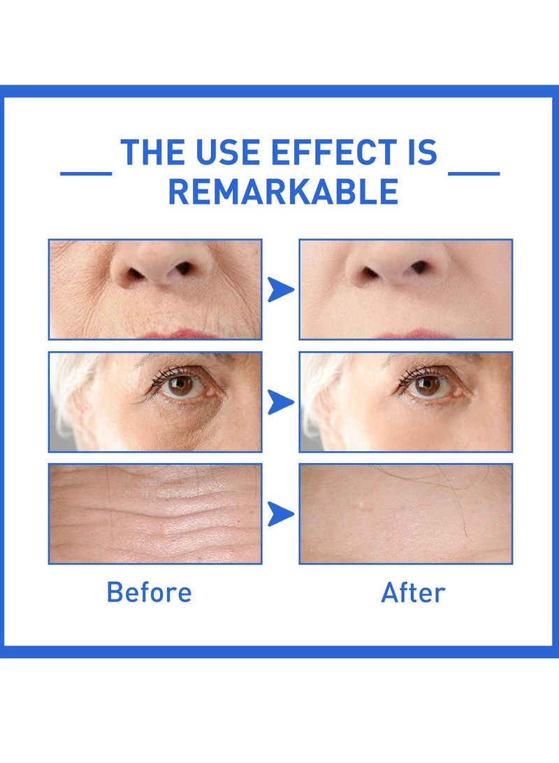 West&Month 2 Bottles Anti-Aging Collagen Serum Suitable For All Skin Fade Dark Spot Removal Pigment Melanin Correcting Nourishing Brighten Face Skin Care Essence 30ml - Image 4
