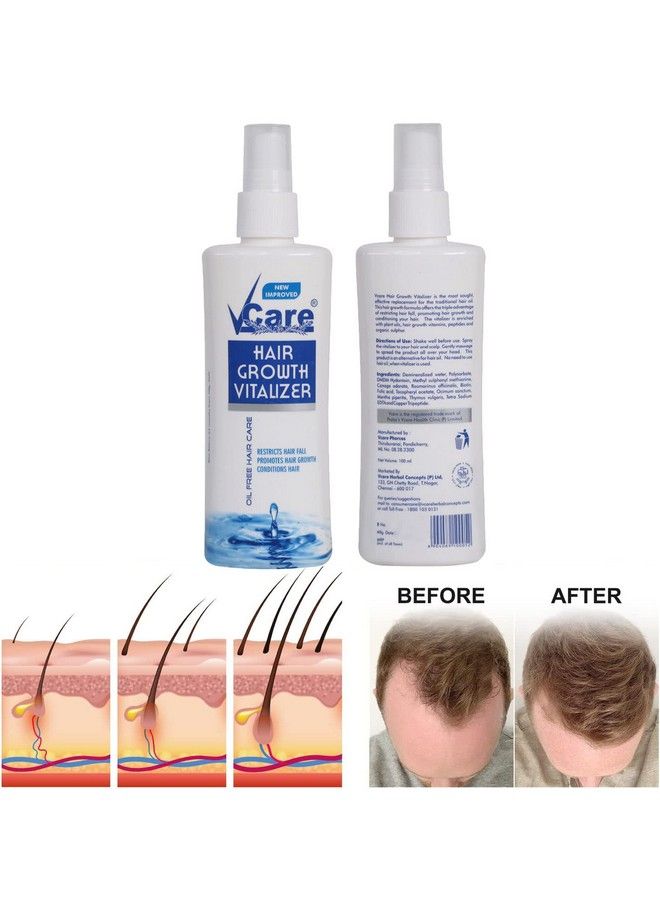 VCare Ayurvedic Hair Growth Vitalizer For Women And Control Dandruff Itching Reduces Hair Fall ; Moisturizer For Dry Head Sulphate And Paraben Free 100 Ml (Pack Of 5) - Image 5