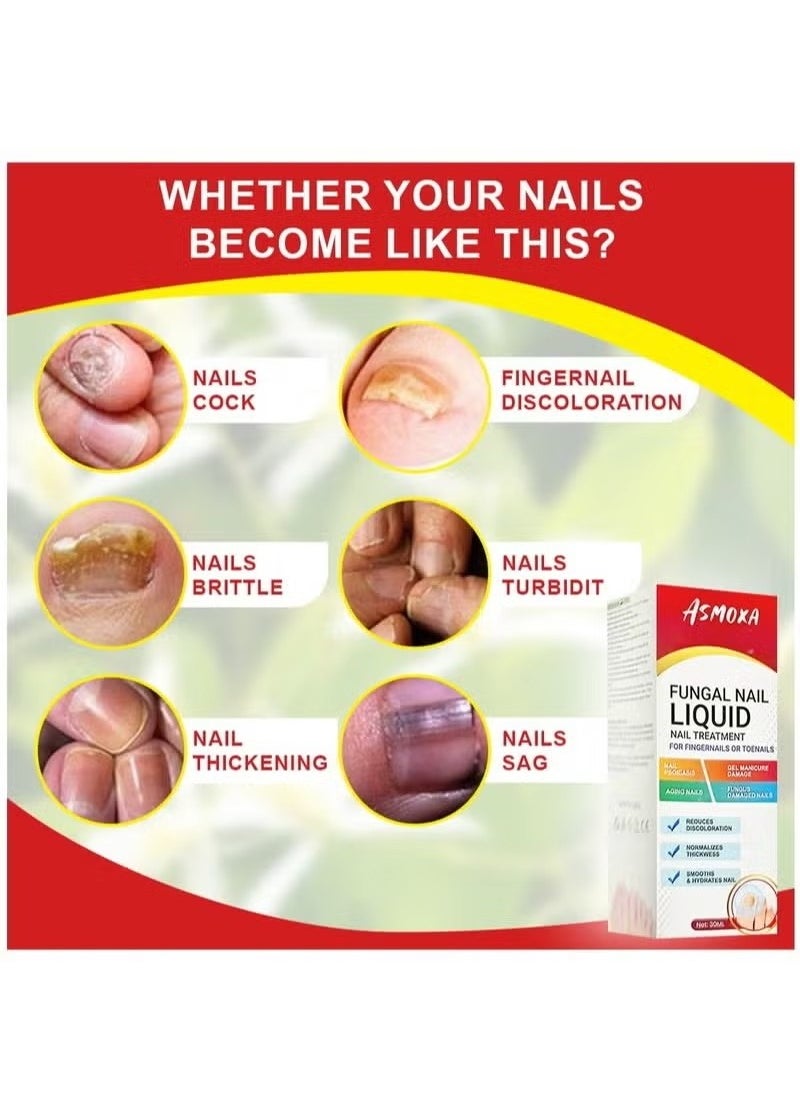 ASMOXA Fungal Nail Treatment Liquid Nail Fungus Treatment for Toenails & Fingernails Fungal Nail Renewal Anti Fungus Nail Repair Smooth & Hydrates Nail Reduce Discoloration 30ml  - Image 4