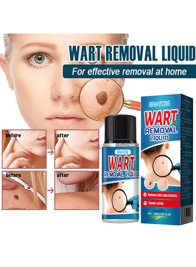 ERAYCEE Wart Removal Liquid, Maximum Strength Salicylic Acid Wart Liquid, One Step Invisible Wart Remover Strips, Fast-Acting Wart Liquid Freeze Off For Warts, Plantar Wart, Common Wart, Flat Wart 30ML - Image 3