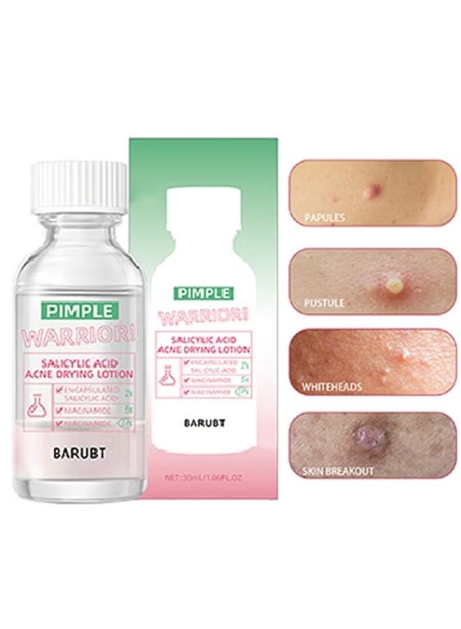 BARUBT Salicylic Acid Acne Drying Lotion-Acne Repair,Promotes Acne Removal,For All Skin Types - Image 1
