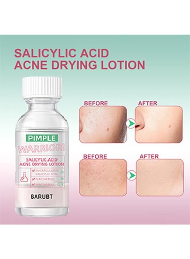 BARUBT Salicylic Acid Acne Drying Lotion-Acne Repair,Promotes Acne Removal,For All Skin Types - Image 3