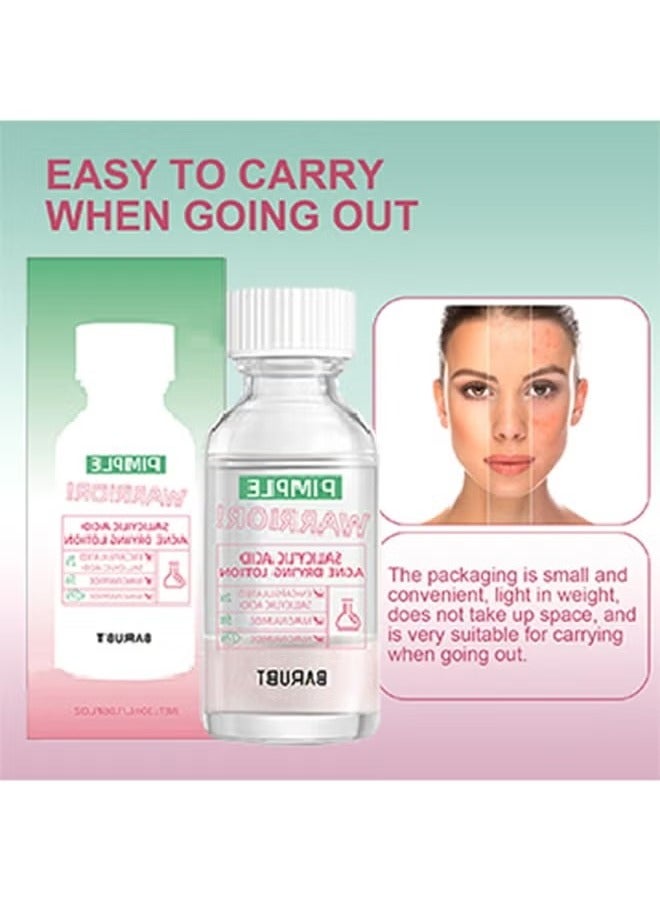 BARUBT Salicylic Acid Acne Drying Lotion-Acne Repair,Promotes Acne Removal,For All Skin Types - Image 5