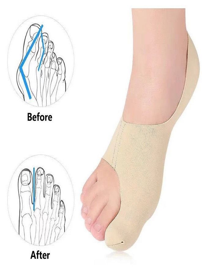 Toe Corrector Pad Sleeve - Image 1