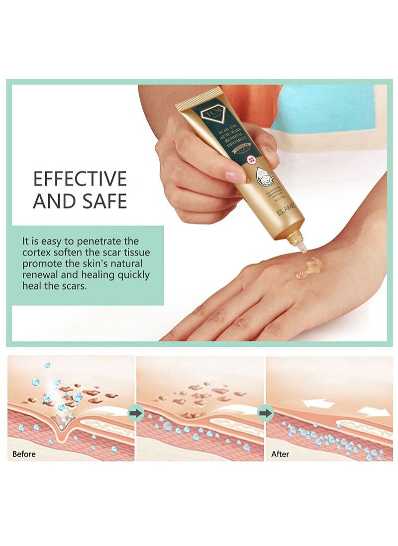 Elaimei - Scar and skin mark anti-inflammatory repairing gel，Scar And Acne Mark Removal Ointment，Scar gel for stretch marks, surgical scars, body and facial acne (30g) - Image 1
