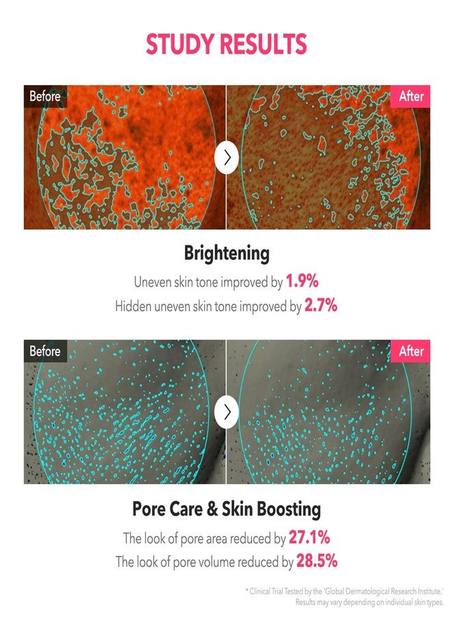 APRILSKIN TXA Niacinamide Toning Shot 99 Spicule Facial Serum｜Skin Booster Serum for Brightening and Pore Care｜99% High-Purity Tranexamic Acid 3% + Niacinamide 5%｜Korean Skin Care｜1.01 fl. oz. - Image 5