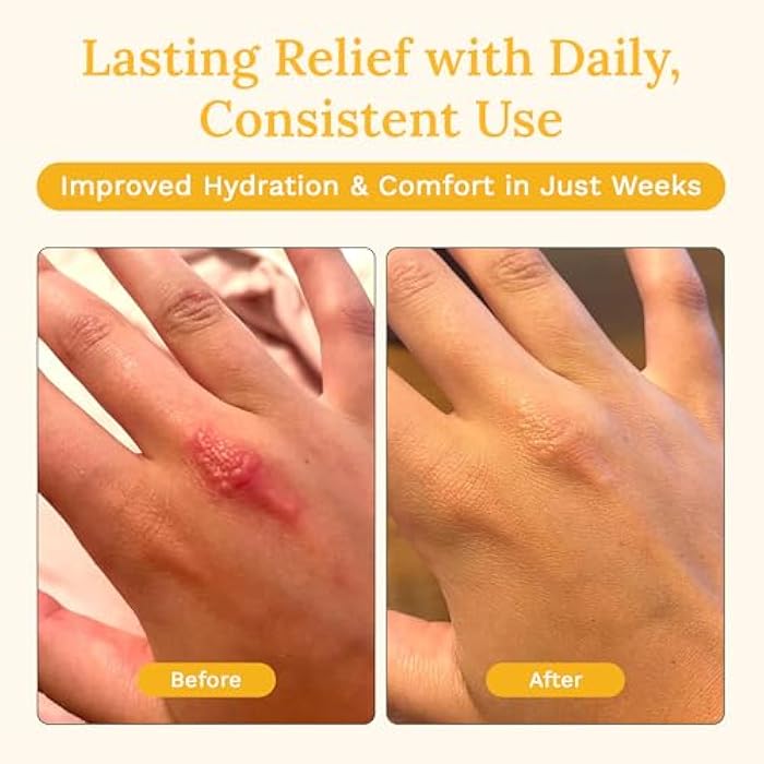 Rejuvaskin Skin Recovery Cream with Aloe Vera, Cooling Moisturizing Cream for Dry, Itchy & Sensitive Skin, 100 ml - Image 5