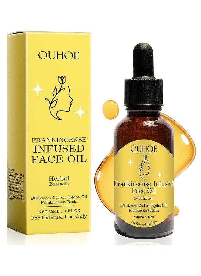 OUHOE Frankincense Resin Oil For Face 30ML, Frankincense Resin Infused Oil For Face, Organic Black Seed Castor And Jojoba Oils, Frankincense Resin Oil Essential, Cold Pressed Serum Anti-Aging Wrinkle  - Image 1