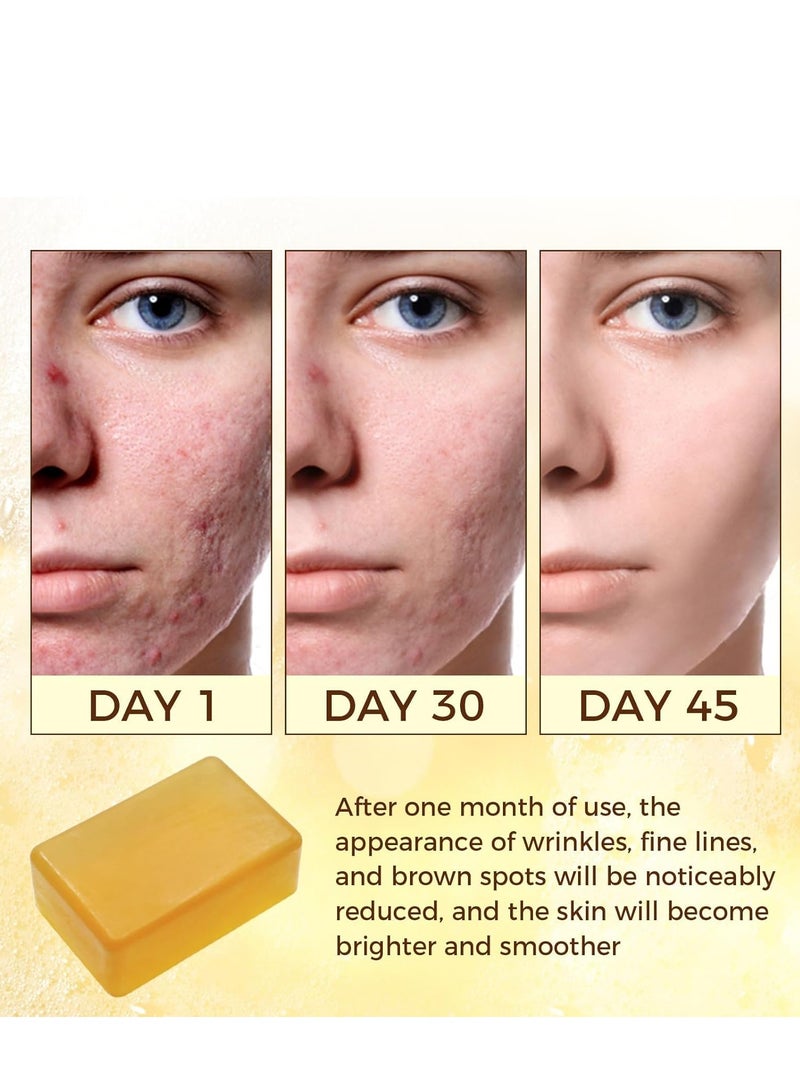 OUKEYA Kojic Acid Dark Spot Remover Soap, Turmeric Soap Bar with Vitamin C, E, Retinol, Collagen & Shea Butter, Hydrating Face & Body Wash Infused with Hyaluronic Acid 115g - Image 2