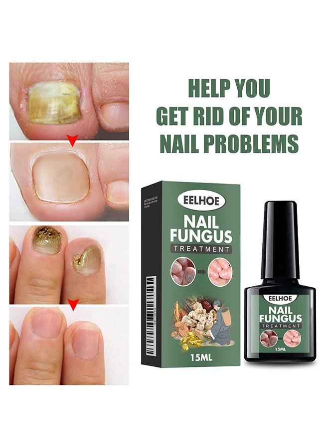 EELHOE Nail Fungus Treatment - Fungal Nail Treatment Solution | Nail Repair and Strengthening | Thickening and Soft Nail Restoration Serum - Image 1