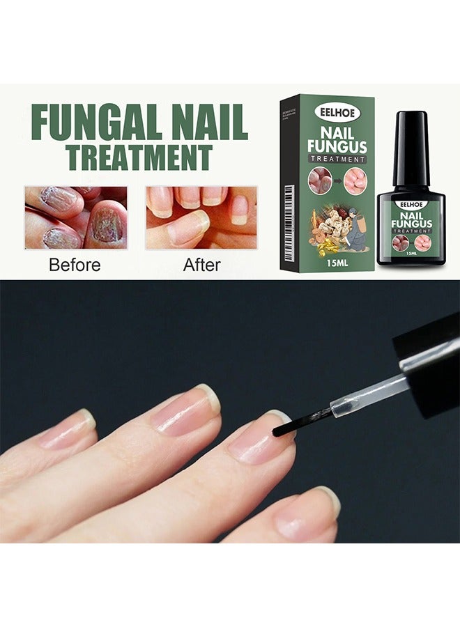 EELHOE Nail Fungus Treatment - Fungal Nail Treatment Solution | Nail Repair and Strengthening | Thickening and Soft Nail Restoration Serum - Image 2