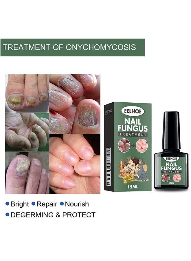 EELHOE Nail Fungus Treatment - Fungal Nail Treatment Solution | Nail Repair and Strengthening | Thickening and Soft Nail Restoration Serum - Image 4