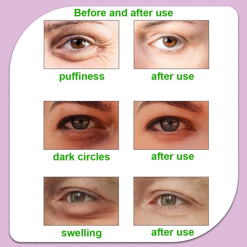 CONBELLA وسادات عيون ساخنة وباردة، لاصقات عيون قابلة لإعادة الاستخدام - مهدئة، revitalizing، تقليل الانتفاخ، انتعاش، تخفيف التوتر، استرخاء، تخفيف الانتفاخ والتوتر (2 بطيخ + 2 خيار) - Image 4