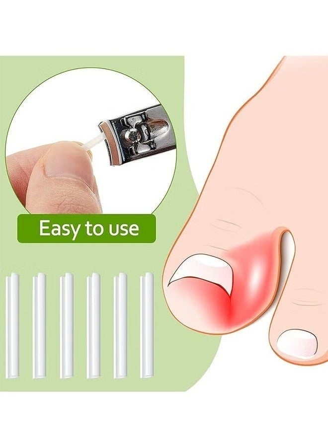 ١٠٠ قطعة من شرائط تصحيح الأظافر الغائرة، لصقات تصحيح الأظافر، مشابك تقويم الأظافر المنحنية، أداة باديكير سميكة لعلاج التهاب حول الظفر، شريط تقويم الأظافر للرجال والنساء، العناية بالقدمين. تتضمن العبوة علبتين، ٥٠ قطعة في كل علبة. - Image 2