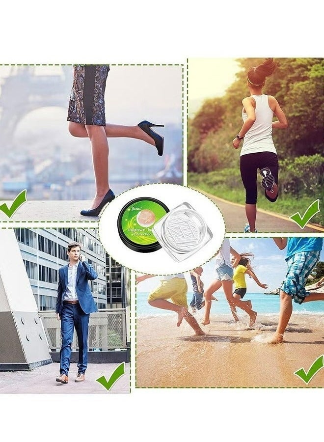 ١٠٠ قطعة من شرائط تصحيح الأظافر الغائرة، لصقات تصحيح الأظافر، مشابك تقويم الأظافر المنحنية، أداة باديكير سميكة لعلاج التهاب حول الظفر، شريط تقويم الأظافر للرجال والنساء، العناية بالقدمين. تتضمن العبوة علبتين، ٥٠ قطعة في كل علبة. - Image 5