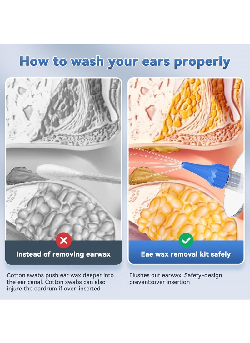 Ru syanl Ear Wax Removal Tool Ear Cleaning Kit Manual Ear Irrigation Flushing System Safe and Effective to Clean Ear Built Up Wax  - Image 4