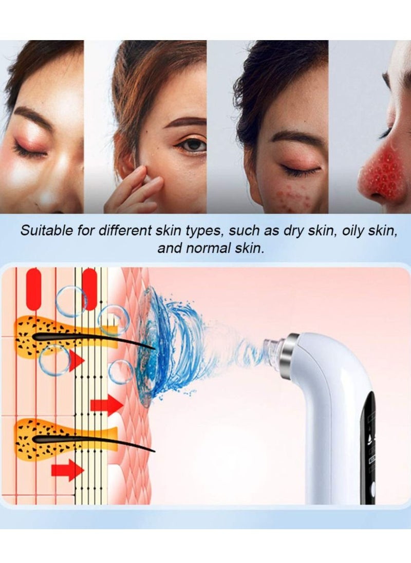 Arabest - Blackhead Remover Vacuum Pore Cleaner Electric Pore Cleaner,Small Bubble Vacuum Suction Electric Blackhead Remover,USB Rechargeable Water Cycle Pores Acne Pimple Extractor Tool - Image 1