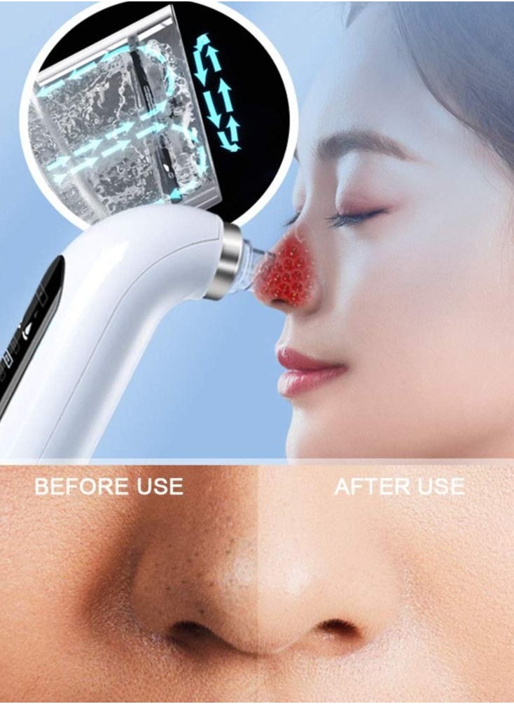 Arabest - Blackhead Remover Vacuum Pore Cleaner Electric Pore Cleaner,Small Bubble Vacuum Suction Electric Blackhead Remover,USB Rechargeable Water Cycle Pores Acne Pimple Extractor Tool - Image 1