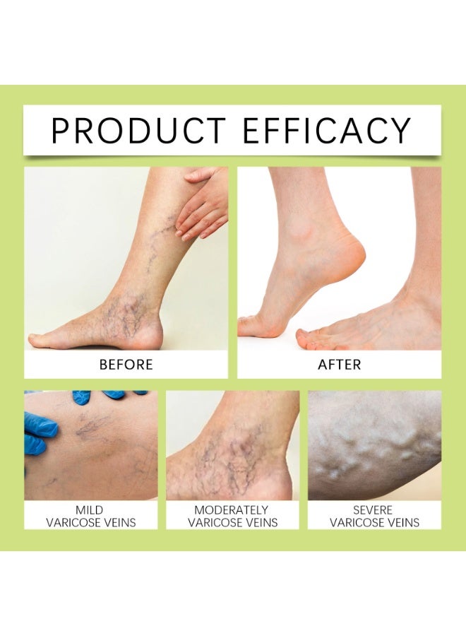 ximonth Miracle Balm for Relieve Itching,Remove Odor,Topical Relief - Image 2