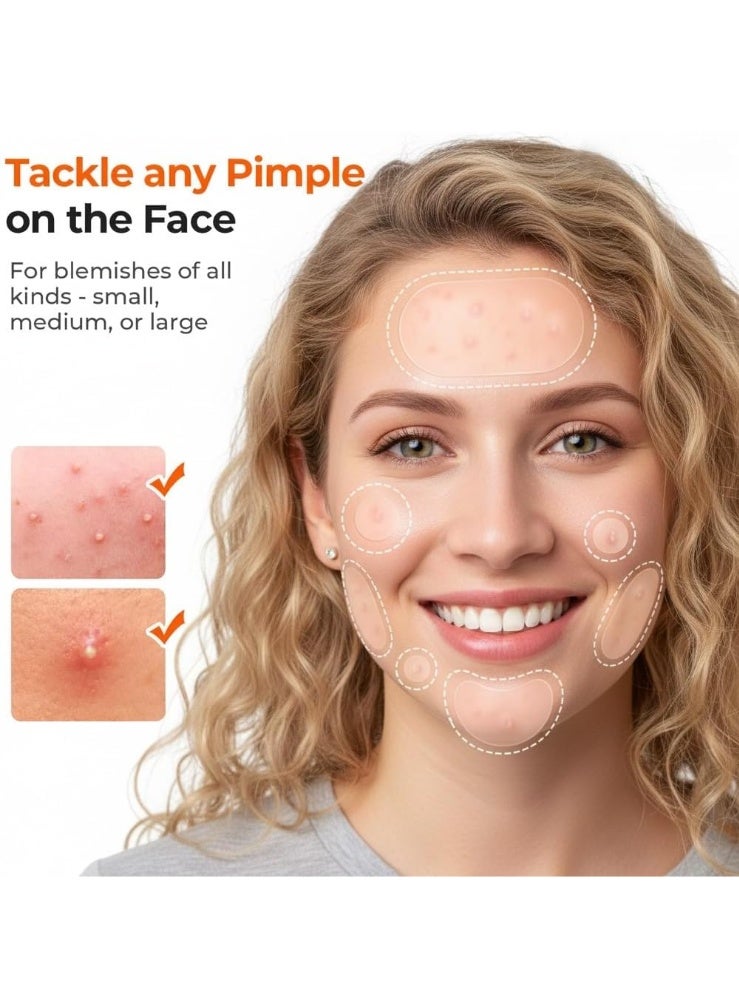 OUHOE 443 Count Hydrocolloid Acne Pimple Patches for Face–Invisible Spot Treatment (Dots, Strips & Contoured Shapes). Smoother skin with this dermatologist-loved, mess-free solution for all skin types. - Image 2