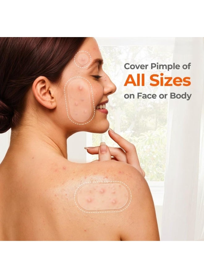 OUHOE 443 Count Hydrocolloid Acne Pimple Patches for Face–Invisible Spot Treatment (Dots, Strips & Contoured Shapes). Smoother skin with this dermatologist-loved, mess-free solution for all skin types. - Image 4
