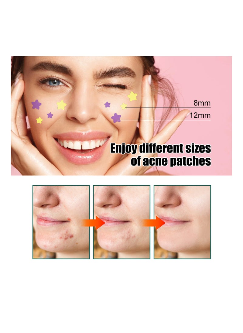EELHOE Acne  Pimple Patch 112 Patches Star Shaped Repair Acne Fade Spots Acne Prints Cover Acne Repair Patch  Repairs Acne And Reduces Scarring Fades Dark Spots And Acne Marks Safe And Gentle On Skin  - Image 4