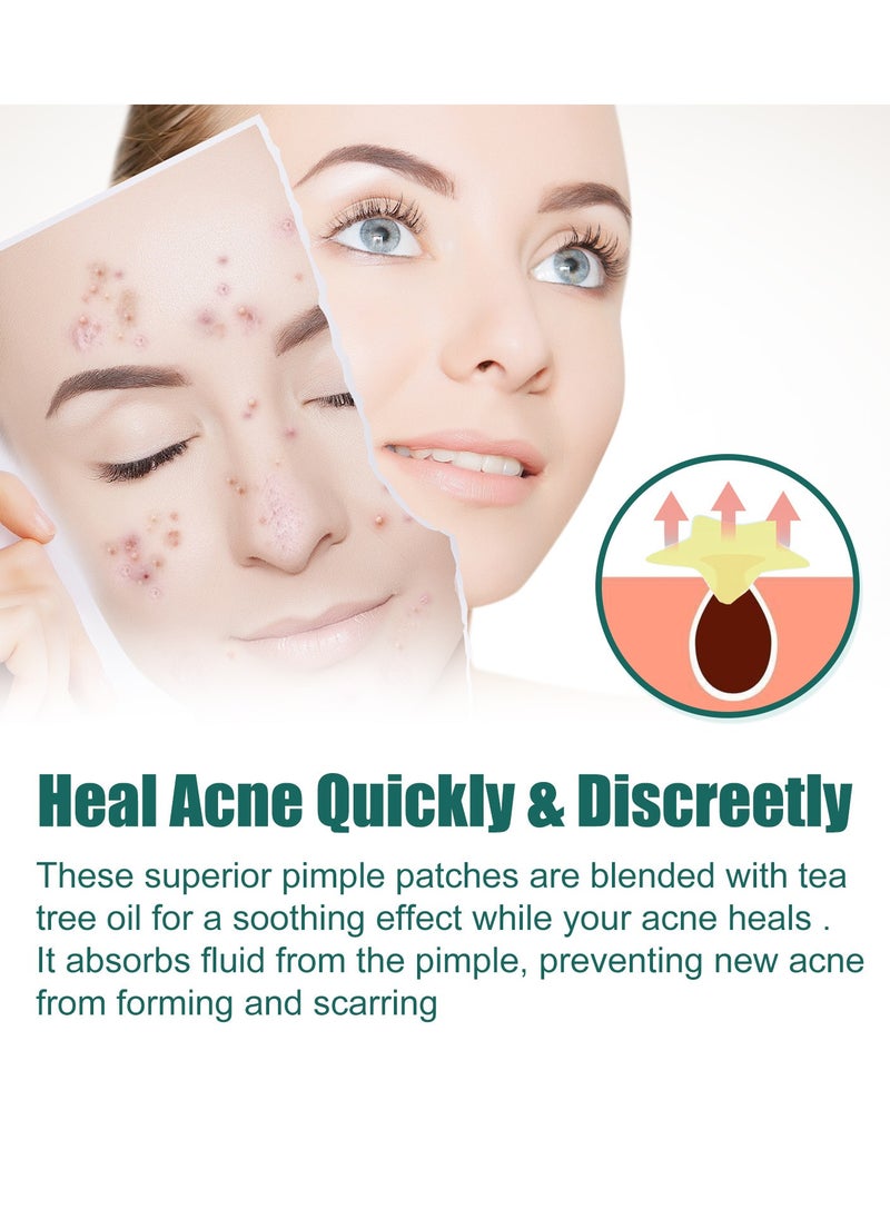EELHOE Acne  Pimple Patch 112 Patches Star Shaped Repair Acne Fade Spots Acne Prints Cover Acne Repair Patch  Repairs Acne And Reduces Scarring Fades Dark Spots And Acne Marks Safe And Gentle On Skin  - Image 3