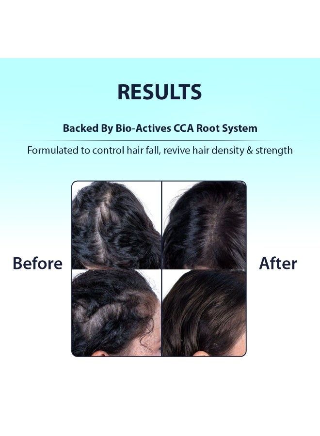 Dermistry Hair Fall Control Mask 200ml for All Hair Types - Image 4
