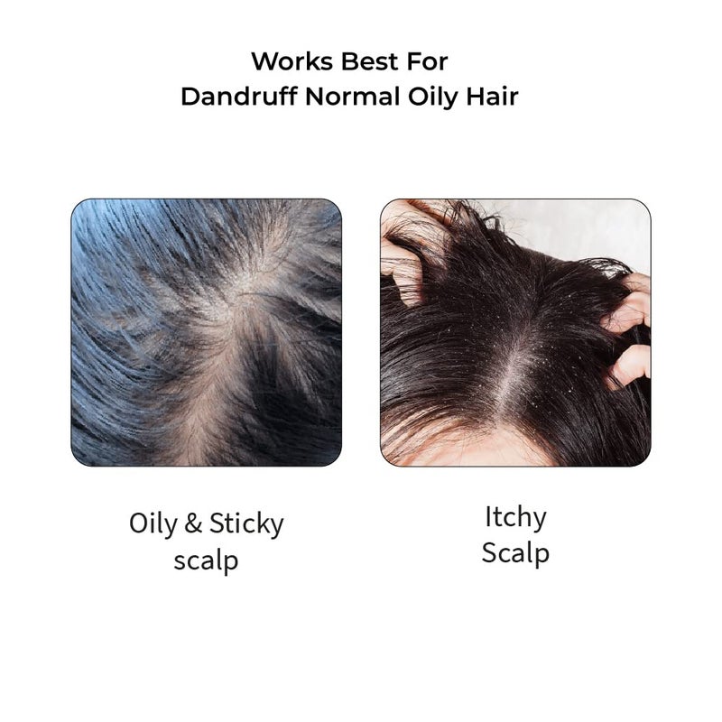Vedix Ayurvedic Hair Care Combo Pack Customized Hair Oil for Dandruff and Anti Dandruff Shampoo for NormalOily Hair with Dry Scalp  Curly Hair  200 ml - Image 4
