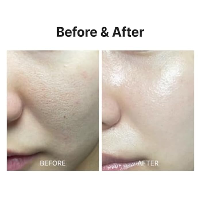MEDITHERAPY Wrinklt-fit Mask(7EA), Collagen Mask, Lifting Sagging Skin, Hydrating & Firming, Smoothing Fine Lines, Improving Elasticity, Glass Skin, Korean Skincare - Image 5