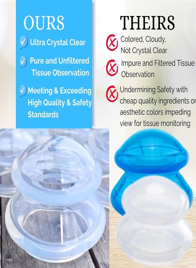Cupping Warehouse TM Cupping Warehouse Supreme 4 Intermediate Pro 5560 Silicone Cupping Set for Beginners – Medical-Grade, for Massage Therapy, Pain Relief, Body Sculpting & Cellulite Reduction, 4 Sizes (S, M, L, XL) - Image 2