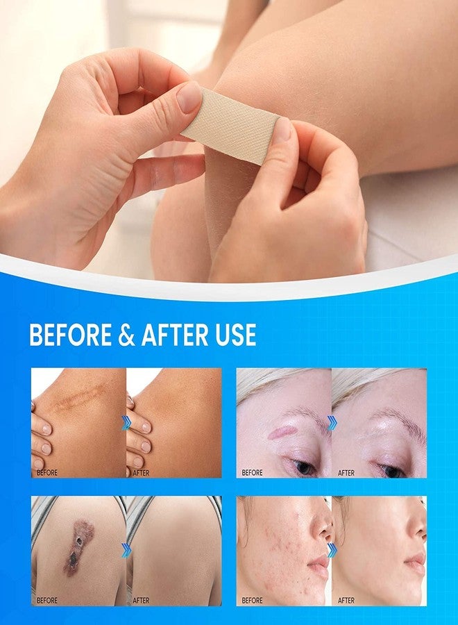 BOXANIA لاصقة جل باتشيال للندبات الكبيرة (15 سم × 12 سم) - Image 4