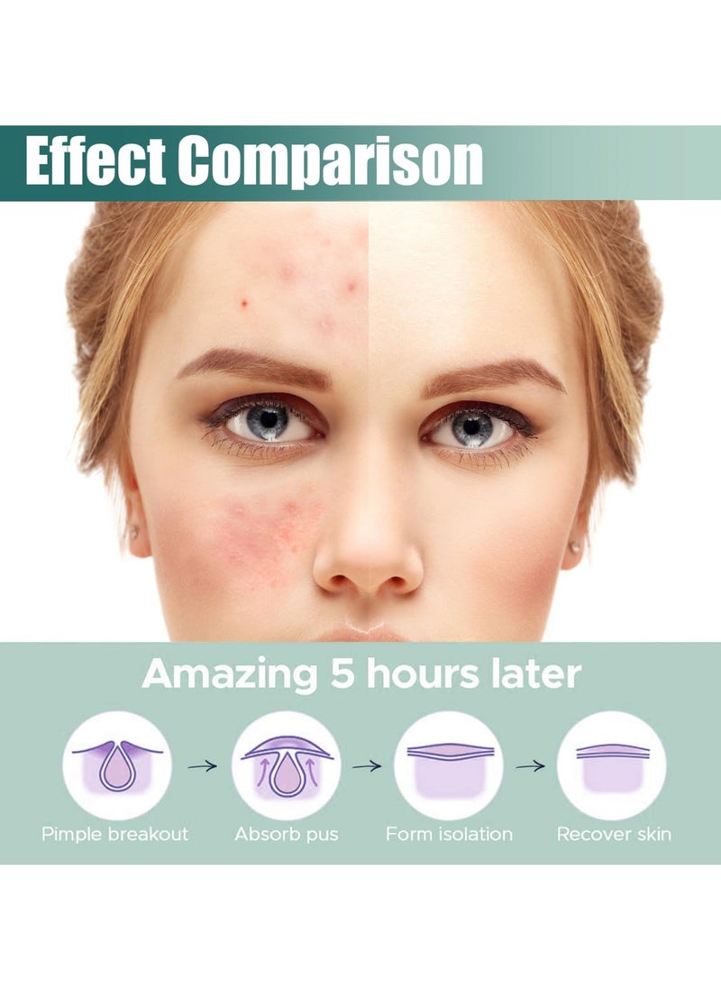 Y&D 2 Pack Pimple Acne Patches, Star-shaped Absorbing Cover Patch Hydrocolloid Spot Dots Stickers for Acne, Blemish, Pimples, Whiteheads Zit (224 Pcs)  - Image 4