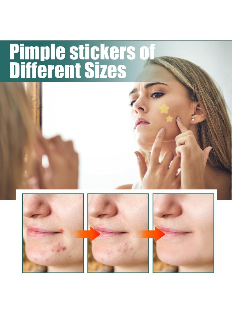 Y&D 2 Pack Pimple Acne Patches, Star-shaped Absorbing Cover Patch Hydrocolloid Spot Dots Stickers for Acne, Blemish, Pimples, Whiteheads Zit (224 Pcs)  - Image 5