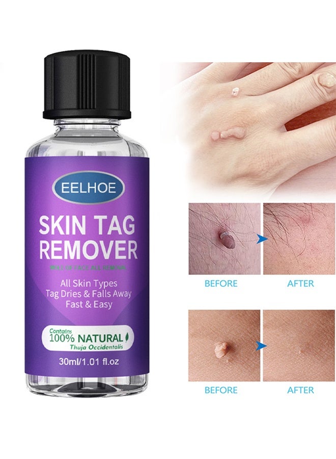 إيلهو مزيل علامات الجلد الطبيعي العضوي 30 مل - Image 1