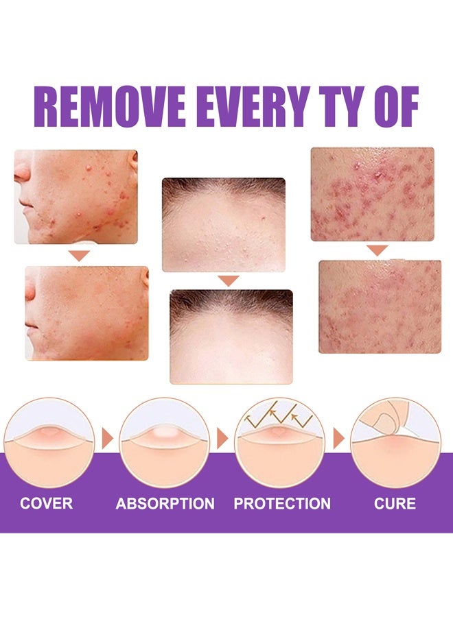 إيلهو مزيل علامات الجلد الطبيعي العضوي 30 مل - Image 5