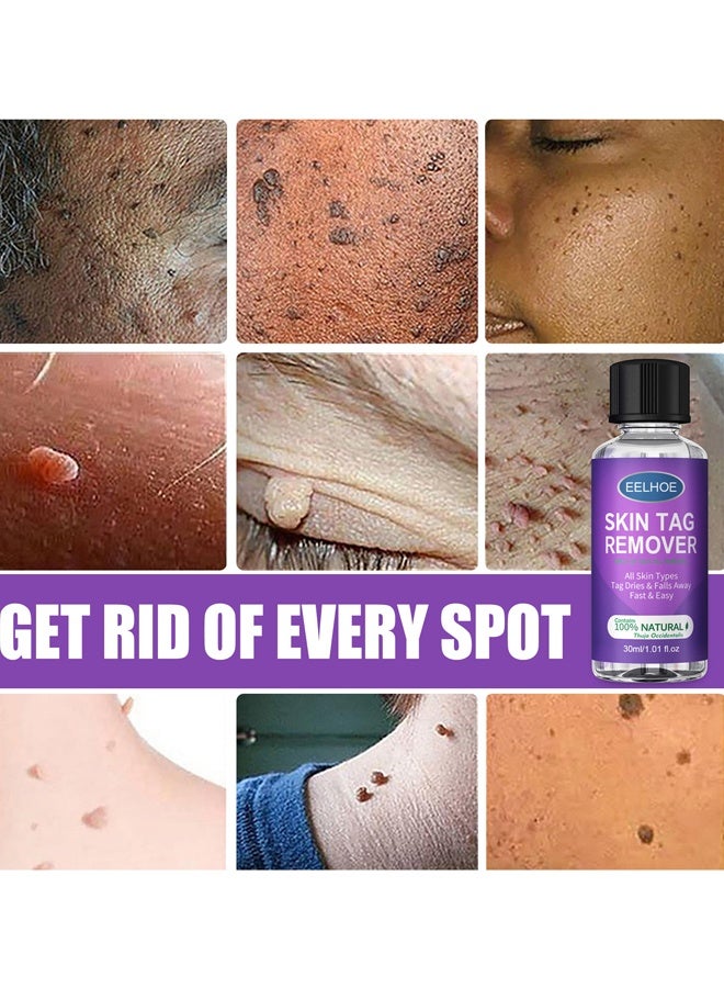 إيلهو مزيل علامات الجلد الطبيعي العضوي 30 مل - Image 3