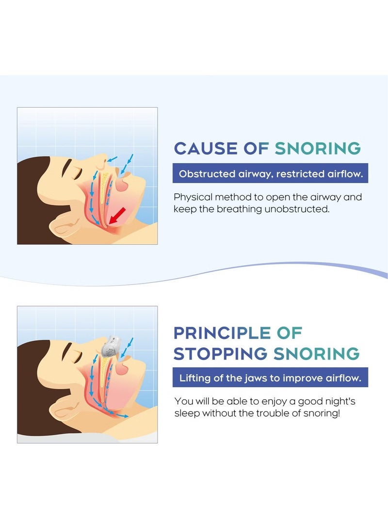 Generic - Anti Snoring Devices, Snoring Solution, Effective Snoring Prevention, Adjustable & Breathable, Snoring Solution for Men and Women, Suitable for All Nose Shapes, Blue - Image 1