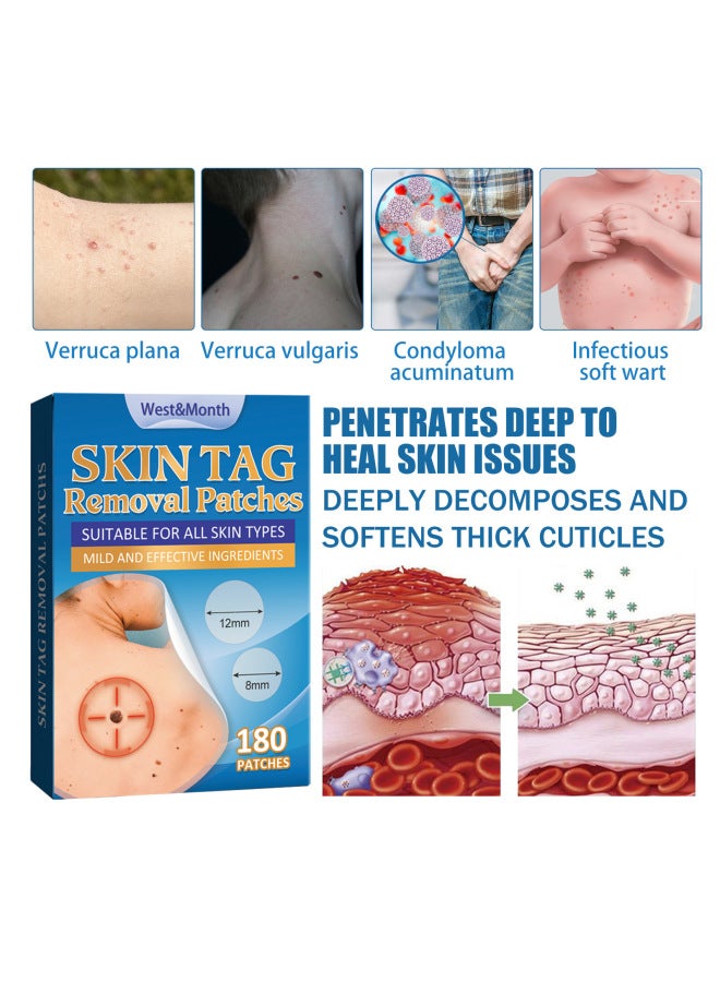 West Month Skin Care Patch Body Skin Cleansing And Curing Smooth Skin Care Patch - Image 2